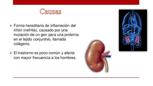 sindrome de alport